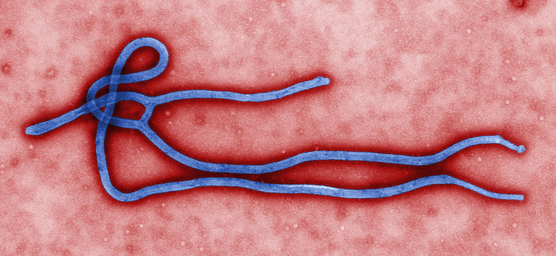 Concerns Rise as Nigeria Reports First Ebola Case in Over a Decade